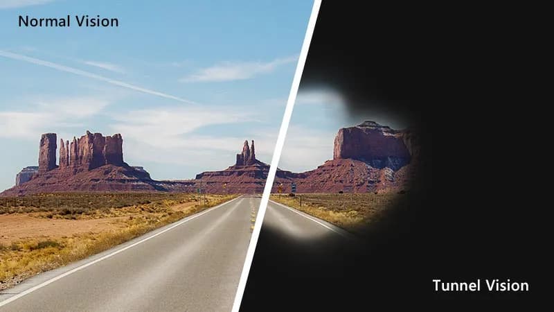 Tunnel Vision - Causes, Prevention and When To Seek Help undefined