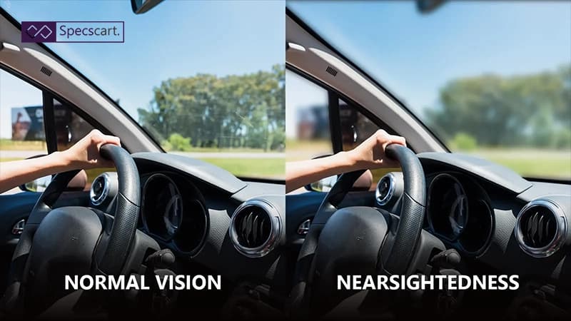 What is Nearsightedness (Myopia)? undefined