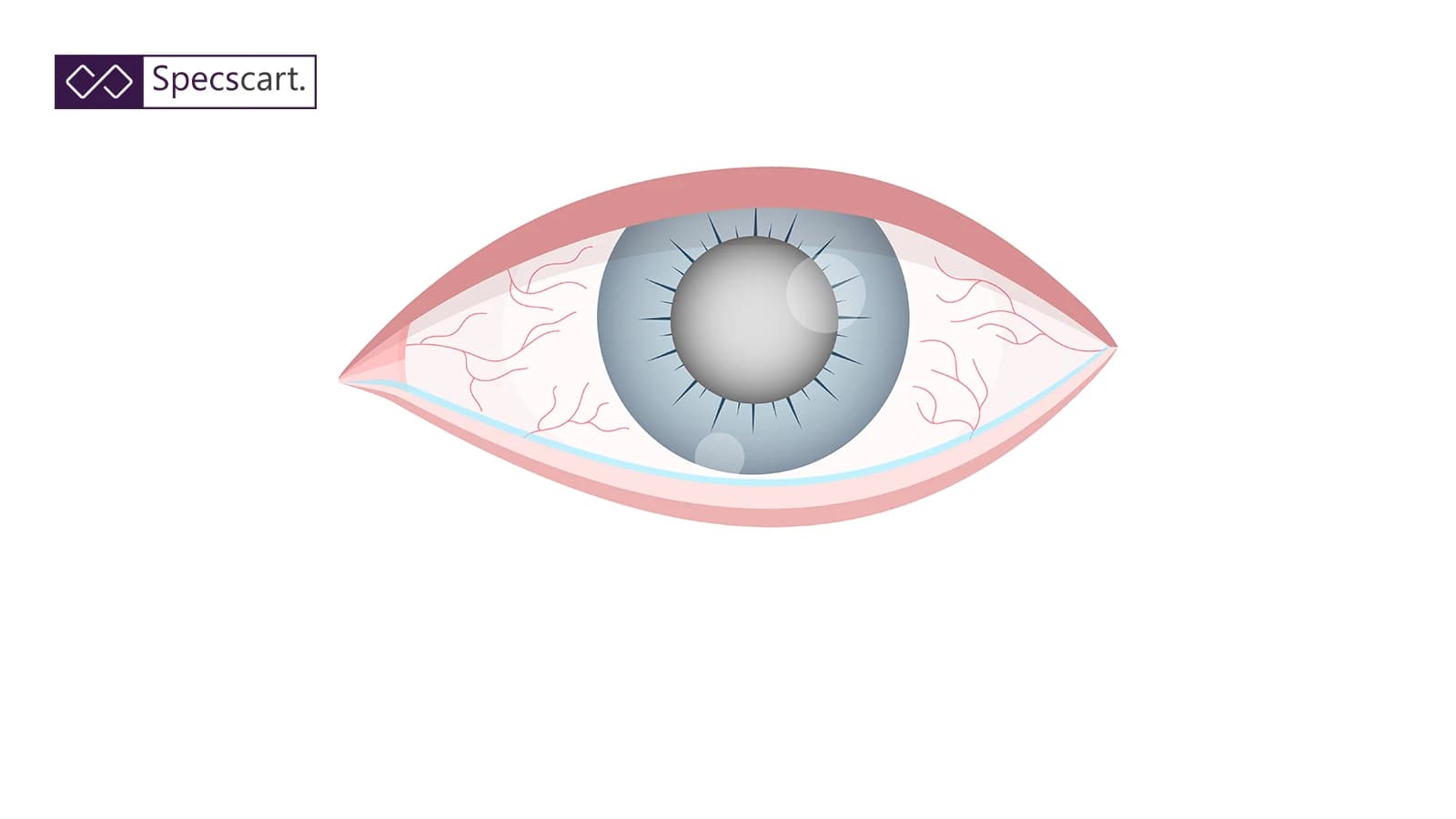 Ultimate Guide to Glaucoma: Causes, Symptoms and Treatment Ultimate Guide to Glaucoma: Causes, Symptoms and Treatment