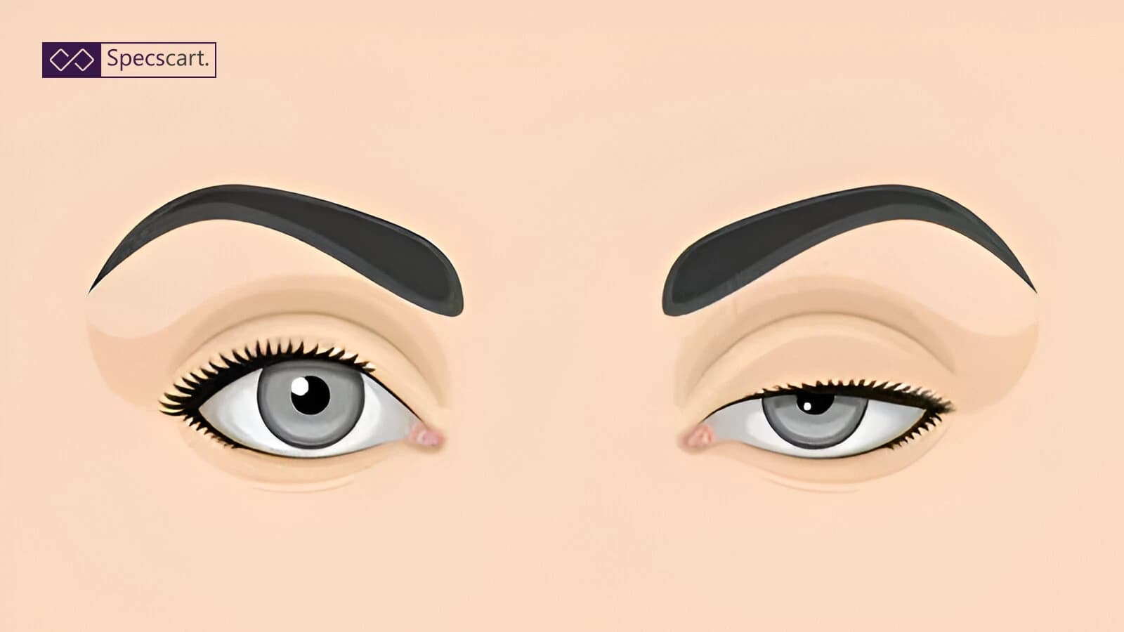 Ptosis: Everything You Need to Know About Eyelid Drooping Ptosis: Everything You Need to Know About Eyelid Drooping