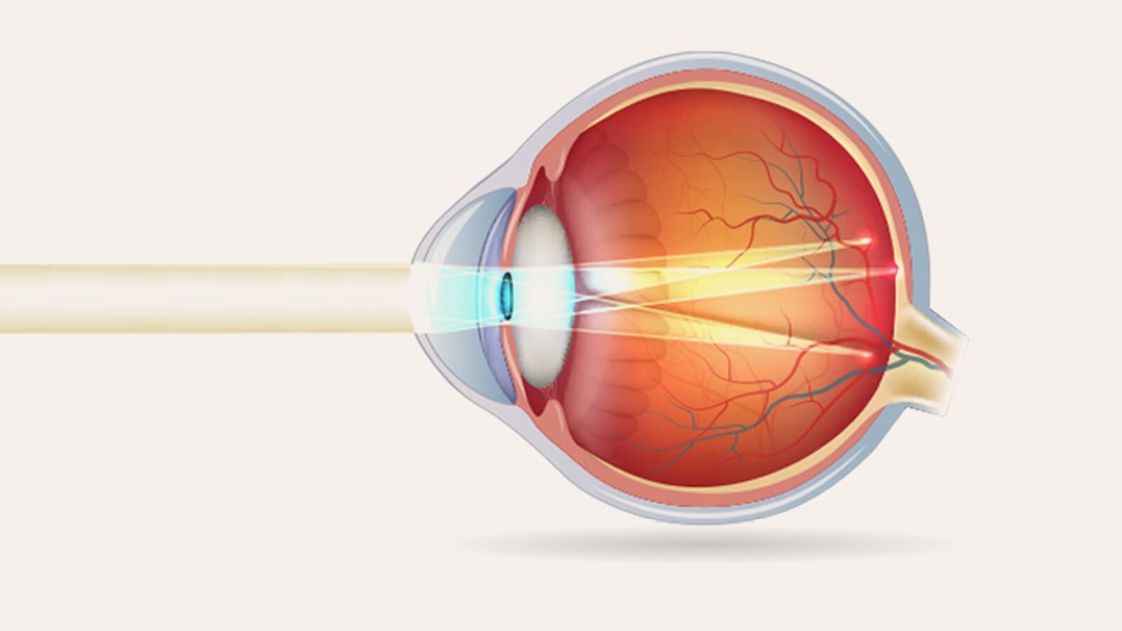 astigmatism night vision