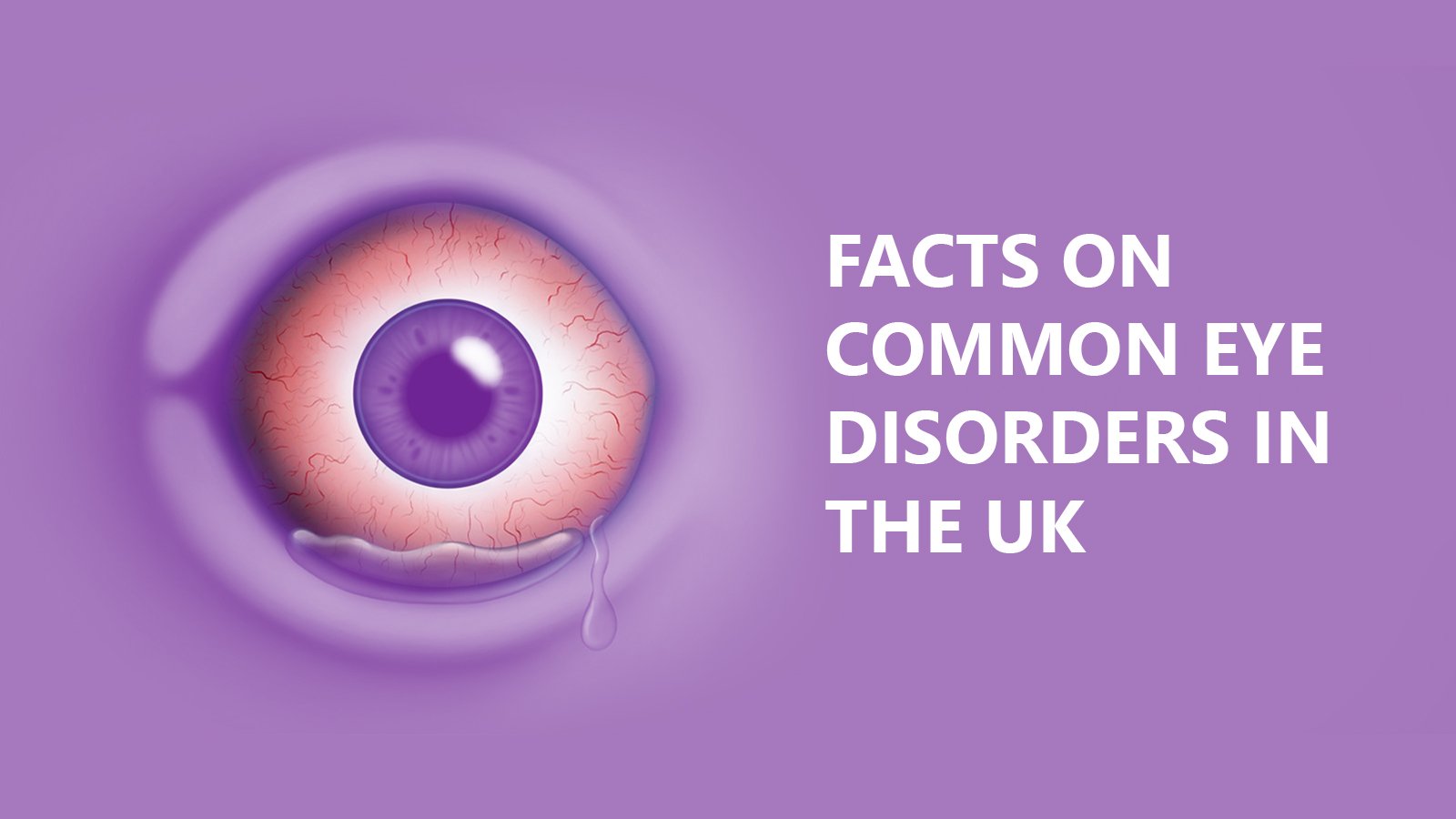 7 Facts on common eye disorders in the UK