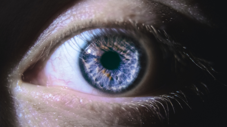 Optic neuritis: What do you need to know about it?