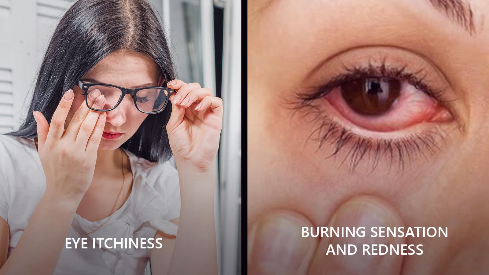 Dry-eye syndrome creates itchiness, burning sensation, redness and often blurred vision in our eyes.