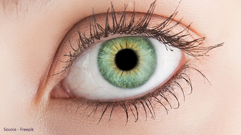 What Causes Green Eyes?